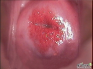 Ԥ�������׵ļ򵥷���