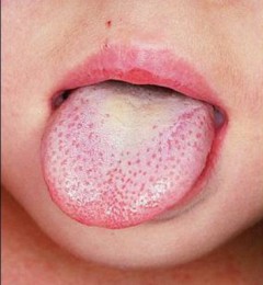 �����뾯���ٶ��ɺ���