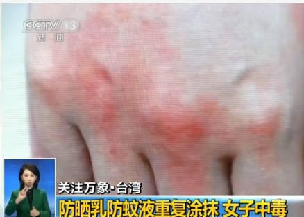 夏天酷暑难挡,蚊子四处作恶,