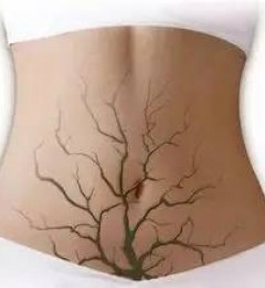 ˽������ ��Ů�˵Ļ����껪ʧɫ