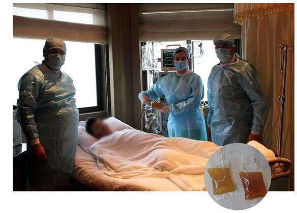 INUS重金属靶向排除技术 排除后的毒素袋