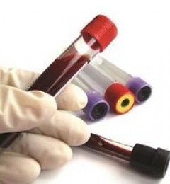 ʲô���ػ�����ѪҺ����