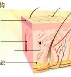 ����Ƥ���Ľṹ�ص� �������޴�̸��