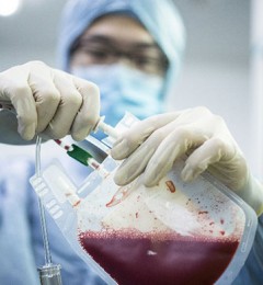 Ϊʲô����ô���϶����Ѫ���ϴ�Ĺ��£�