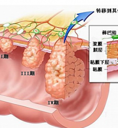 �ִ��˳����߷� ������Ժ�������й�