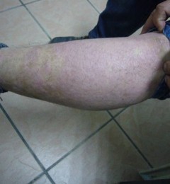 �չ˺����Ƥ�� Զ��Ƥ��������