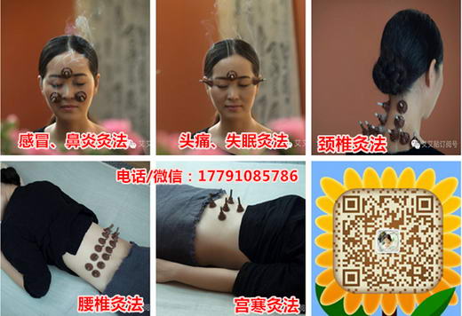 艾艾贴代理后会好卖吗?找谁代理会好些?艾艾贴总代刘倩