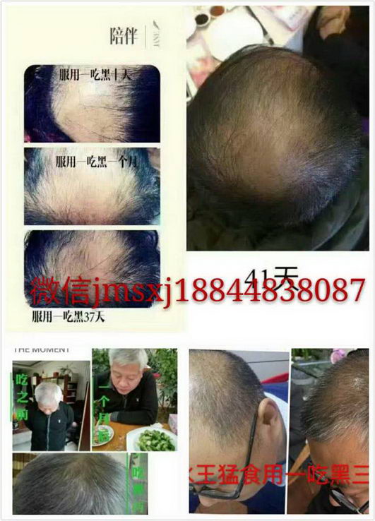 德世久一吃黑总代王迪带你共创财富。电话18844838087