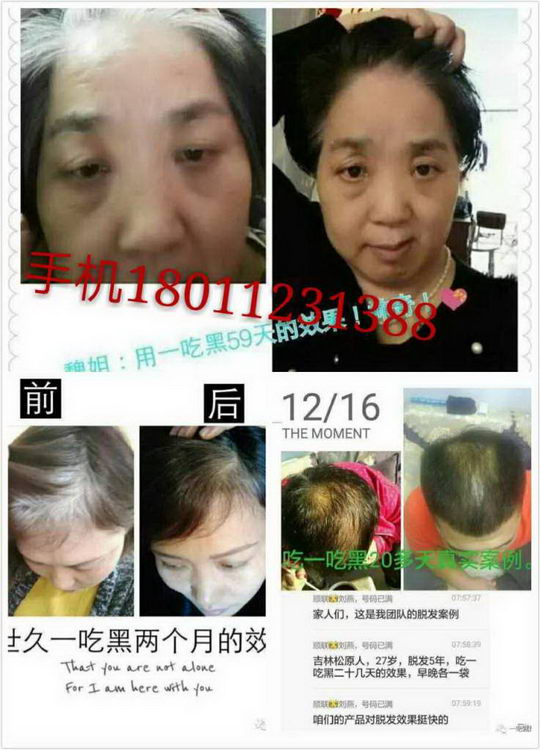 德世久一吃黑营养粉效果好不好,是不是忽悠人的?