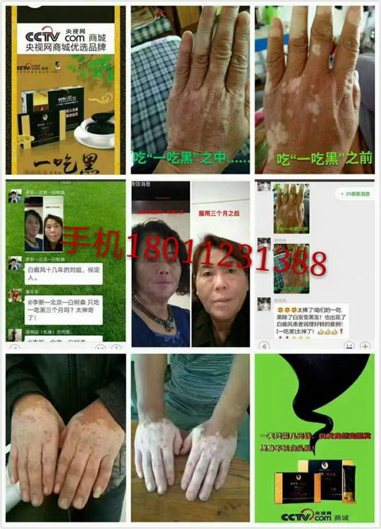 德世久一吃黑营养粉效果好不好,是不是忽悠人的?