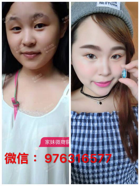 娇点燃脂有依赖性吗?会不会把人吃坏?娇点燃脂创始人家妹