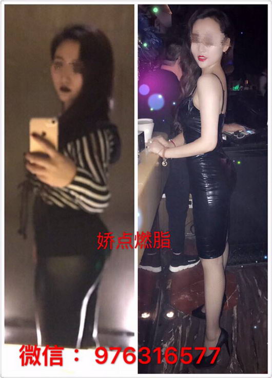 娇点燃脂有依赖性吗?会不会把人吃坏?娇点燃脂创始人家妹