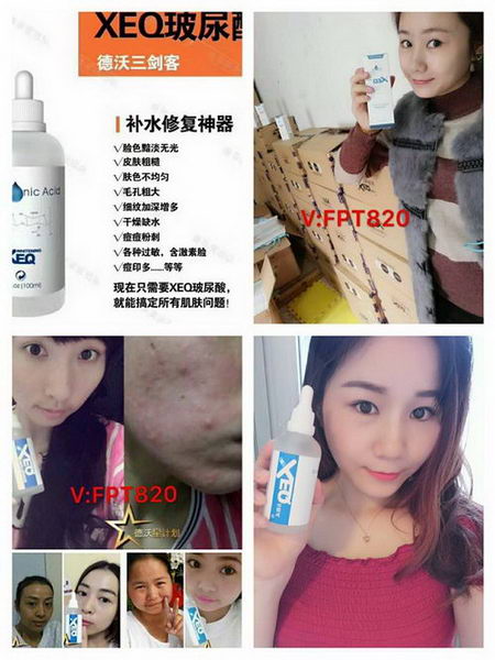 佳茵益生菌的成分是什么?佳茵广东汕头总代V:FPT820