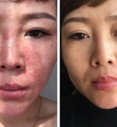 �������������ƣ�3�꼤��Ƥ�������2���³����޸���