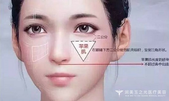 原生态苹果肌笑起来是怎样的感觉?【问王明利】