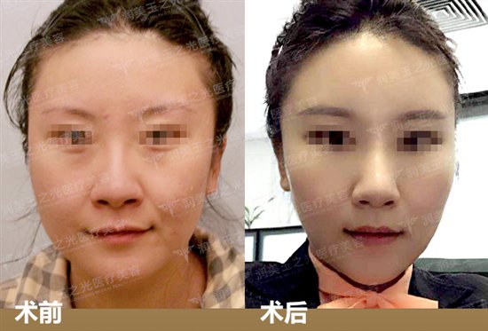 原生态苹果肌笑起来是怎样的感觉?【问王明利】