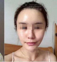 ������ר��������V�ܼӡ���֬�����Ϊ��