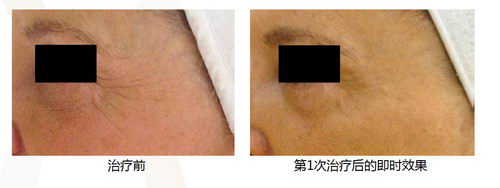 ˿ഺ coming soon...