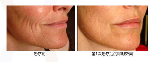 ˿ഺ coming soon...