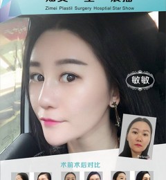 ��ݸ֪��¡�ǻ�ʧ���𣿹轺¡����������