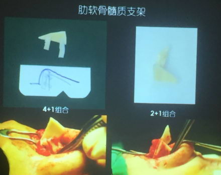 ҽרȾԺμӴ˴ѧʢᣬ⡶ڱ޸еӦá