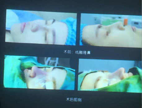 ҽרȾԺμӴ˴ѧʢᣬ⡶ڱ޸еӦá