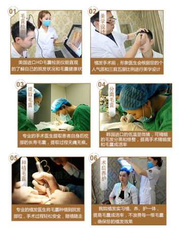 深圳新生植发揭秘如何选择靠谱的植发医院