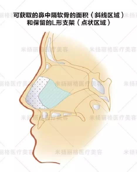 北京米扬丽格医院靠谱吗 打造杰出医美平台,追求杰出服务品质