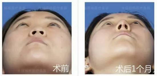 北京米扬丽格医院靠谱吗 打造杰出医美平台,追求杰出服务品质