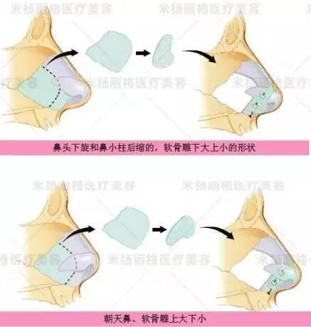 北京米扬丽格医院靠谱吗 打造杰出医美平台,追求杰出服务品质