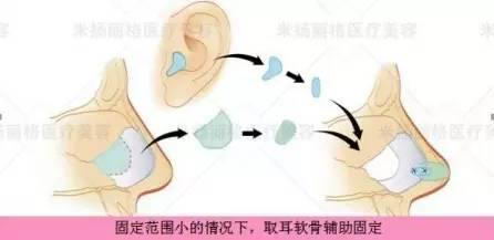 北京米扬丽格医院靠谱吗 打造杰出医美平台,追求杰出服务品质