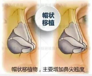 北京米扬丽格医院靠谱吗 打造杰出医美平台,追求杰出服务品质