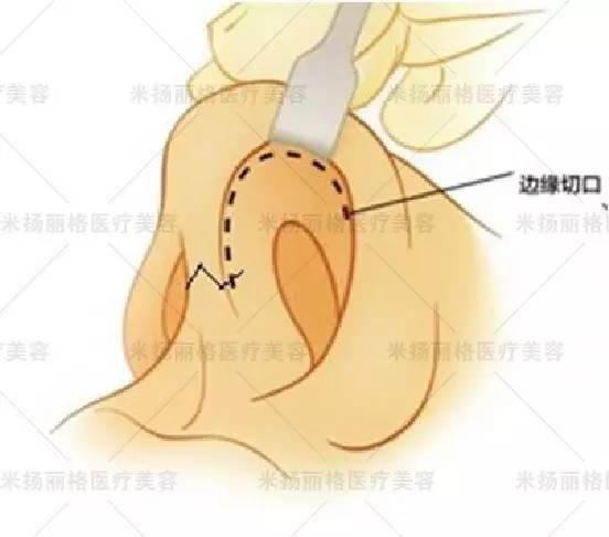 北京米扬丽格医院靠谱吗 打造杰出医美平台,追求杰出服务品质