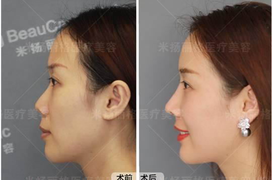 北京米扬丽格医院靠谱吗 打造杰出医美平台,追求杰出服务品质