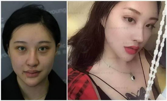 北京米扬丽格医院靠谱吗 打造杰出医美平台,追求杰出服务品质