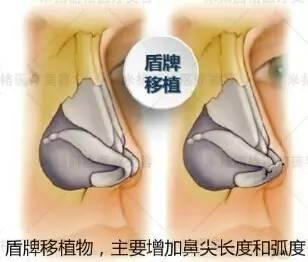 北京米扬丽格医院靠谱吗 打造杰出医美平台,追求杰出服务品质