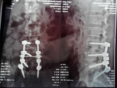 򲡻׵ͻôΣٵ¹ǿƸ