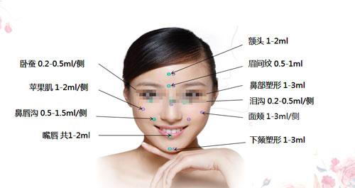 长沙瑞澜医疗美容医院,伊婉玻尿酸新产品怎么样?