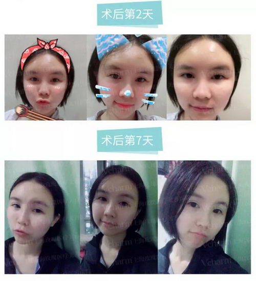 Vcharm콢꡿õ֬ȫ沿