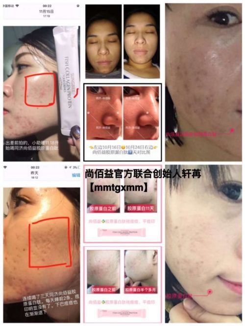 尚佰益胶原蛋白怎么代理?尚佰益胶原蛋白一盒价格是多少?