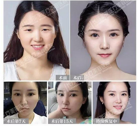 ɳҽҽԺŮӸ˫Ƥ20º Ƿ֮ķ