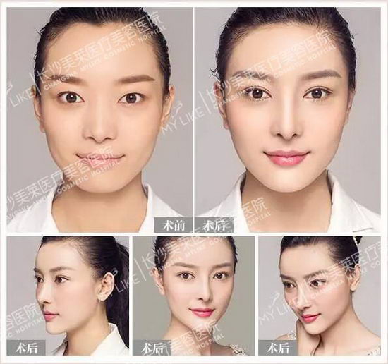 ɳҽҽԺŮӸ˫Ƥ20º Ƿ֮ķ