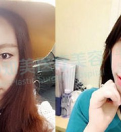 ��ݸ֪������˫��Ƥ�޸�����Ϊʲô��ô�ѣ�