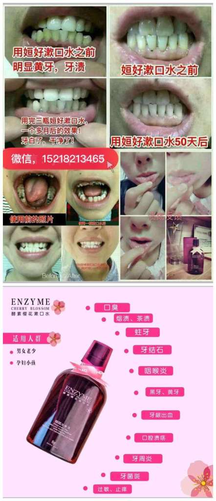 樱花漱口水孕妇小孩可以吗?含有酒精吗?