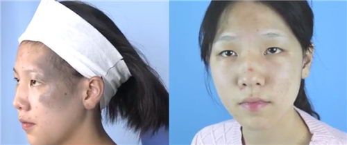 ϲƤ ΪèŮСȥ̥