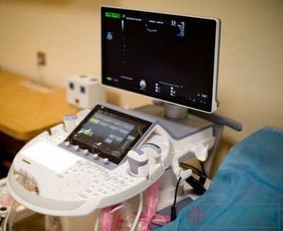 无锡虹桥医院怎么样好吗?胎儿排畸新王者E10四维彩超入驻