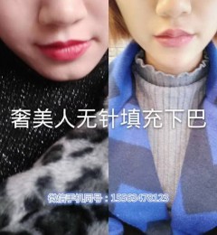 ����������΢����������������Ч����Σ�