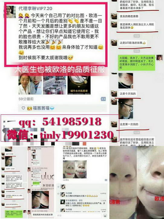 欧洛蜗牛弹力柔肤水_欧洛护肤品婷婷诚招全国代理商