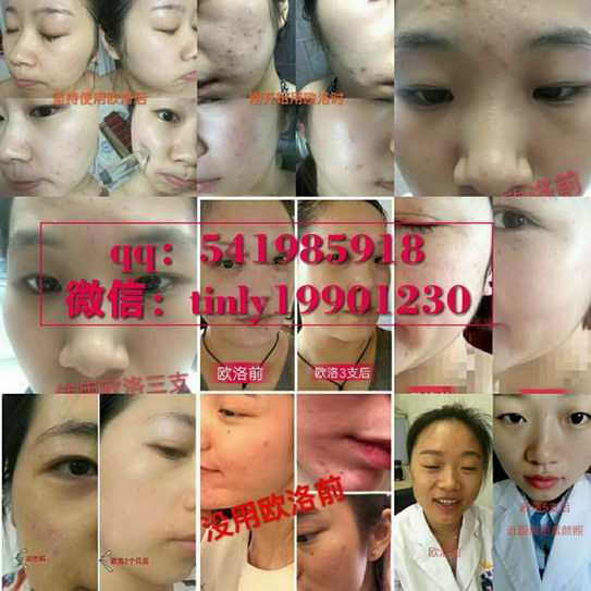 欧洛蜗牛弹力柔肤水_欧洛护肤品婷婷诚招全国代理商