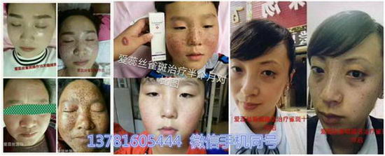 2018年美业什么项目好? 法国爱蕊丝皮肤管理值得投资吗?